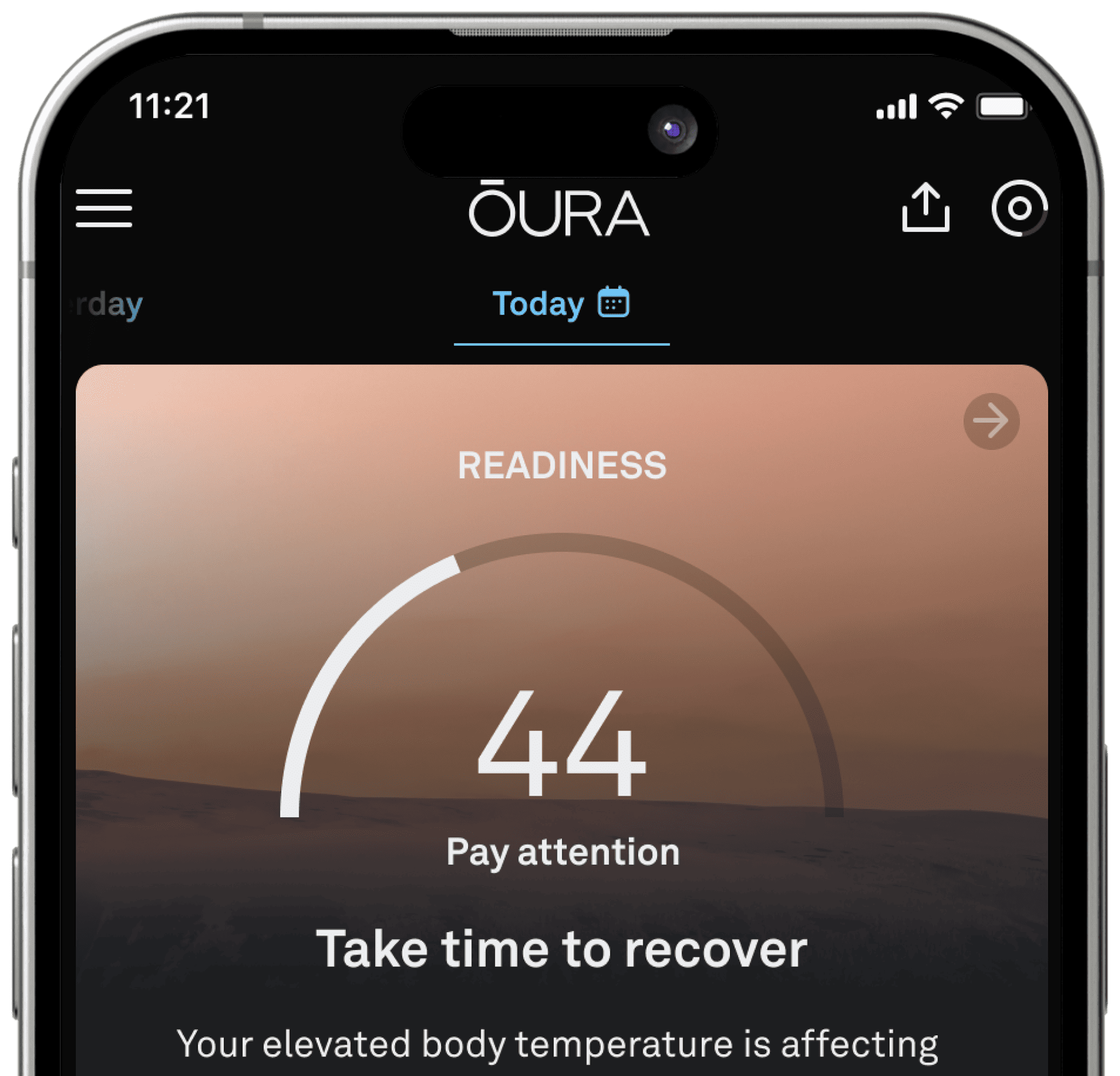 Oura-mobile-Illness-Detection-img